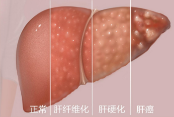 챨ЩΣմʡǰ֢ǰ