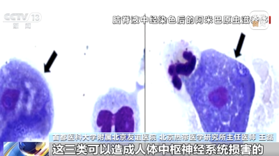 һʳԳ桱ҽѡ