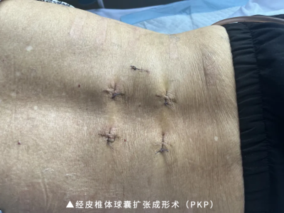 1762569148619319.png 02.png