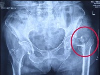 1764918924912778.jpg 01.jpg