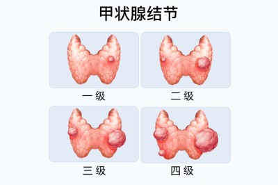 ��״�ٱ�������쳣�ȱ�ţ�ҽ������ʶ��